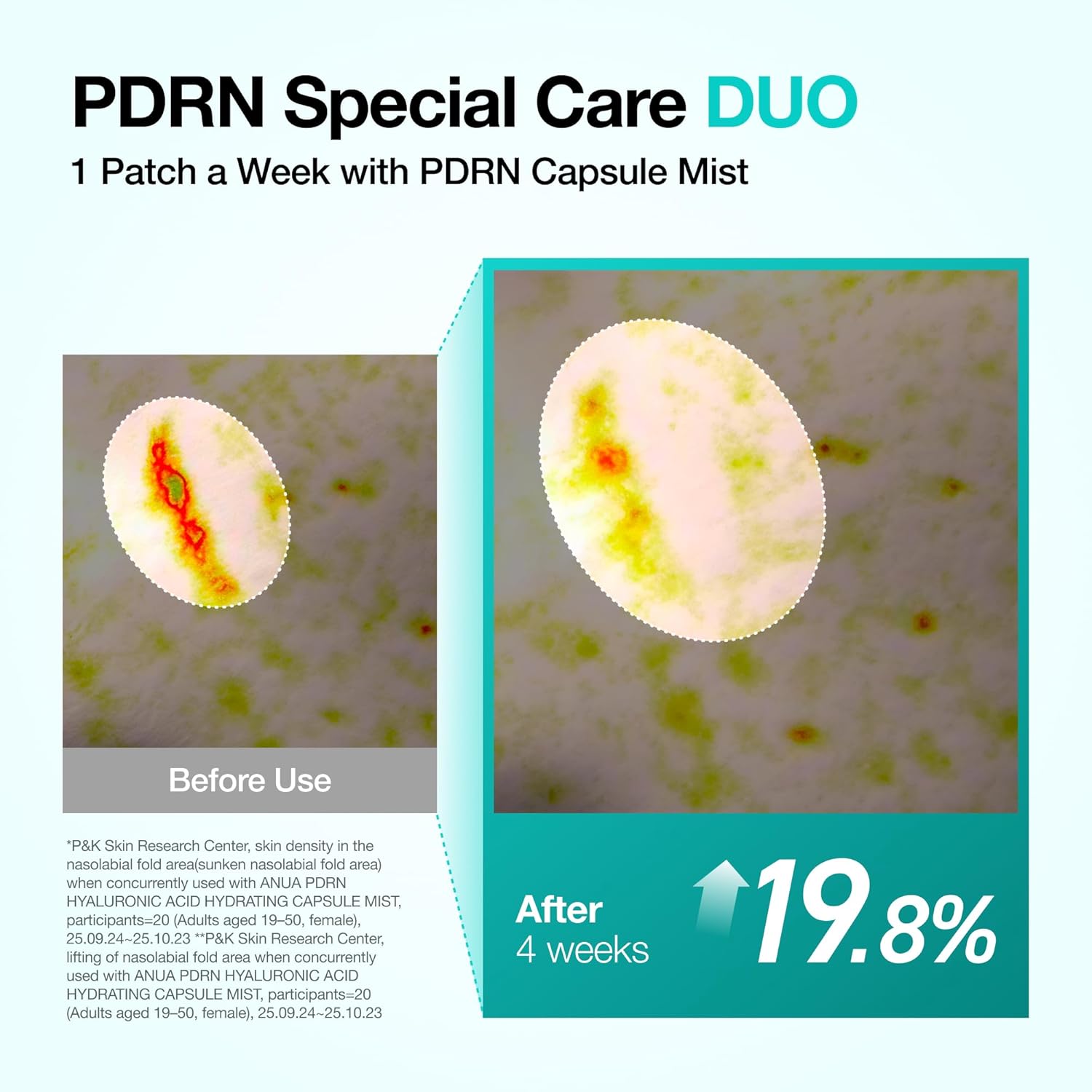 Anua Salmon DNA PDRN Collagen Melting Patch for Glass skin, Smile Line Patches, Wrinkle Patches, Melting Thin Collagen Patch, Firming for Fine Lines, Glow, Hydrating, Korean Skincare, 2 Pairs x 4EA