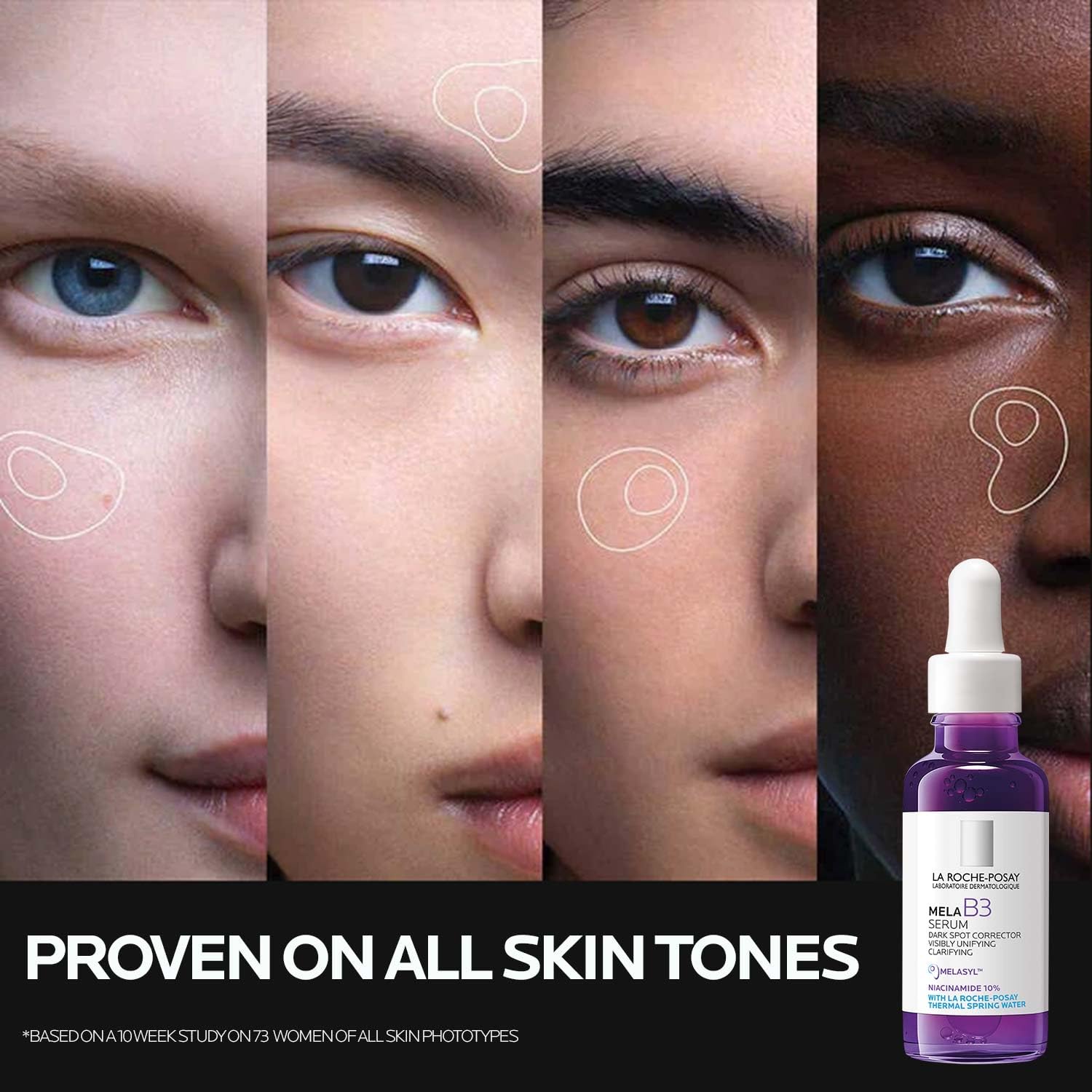 La Roche-Posay Mela B3 Serum, Dark Spot Corrector With Anti-Aging Melasyl + 10% Niacinamide, Discoloration Correcting Serum for Sun Spots, Age Spots & Post-Acne Marks